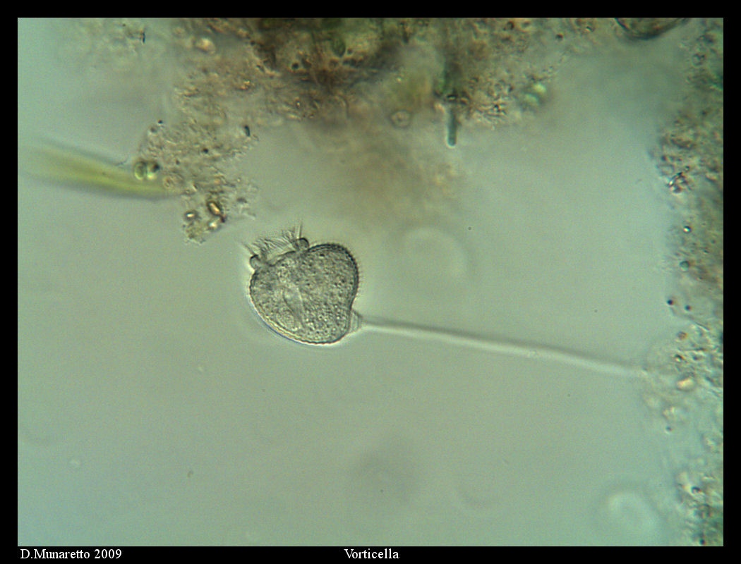 Vorticella